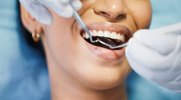 Best Cracked Tooth Emergency Dentist  in Spring, TX